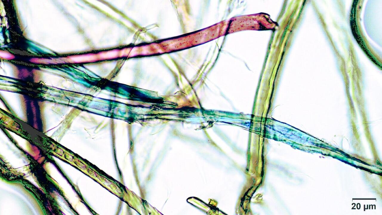 Mikroplastik-Studie: Erwachsene nehmen jährlich bis zu 212.000 Partikel auf