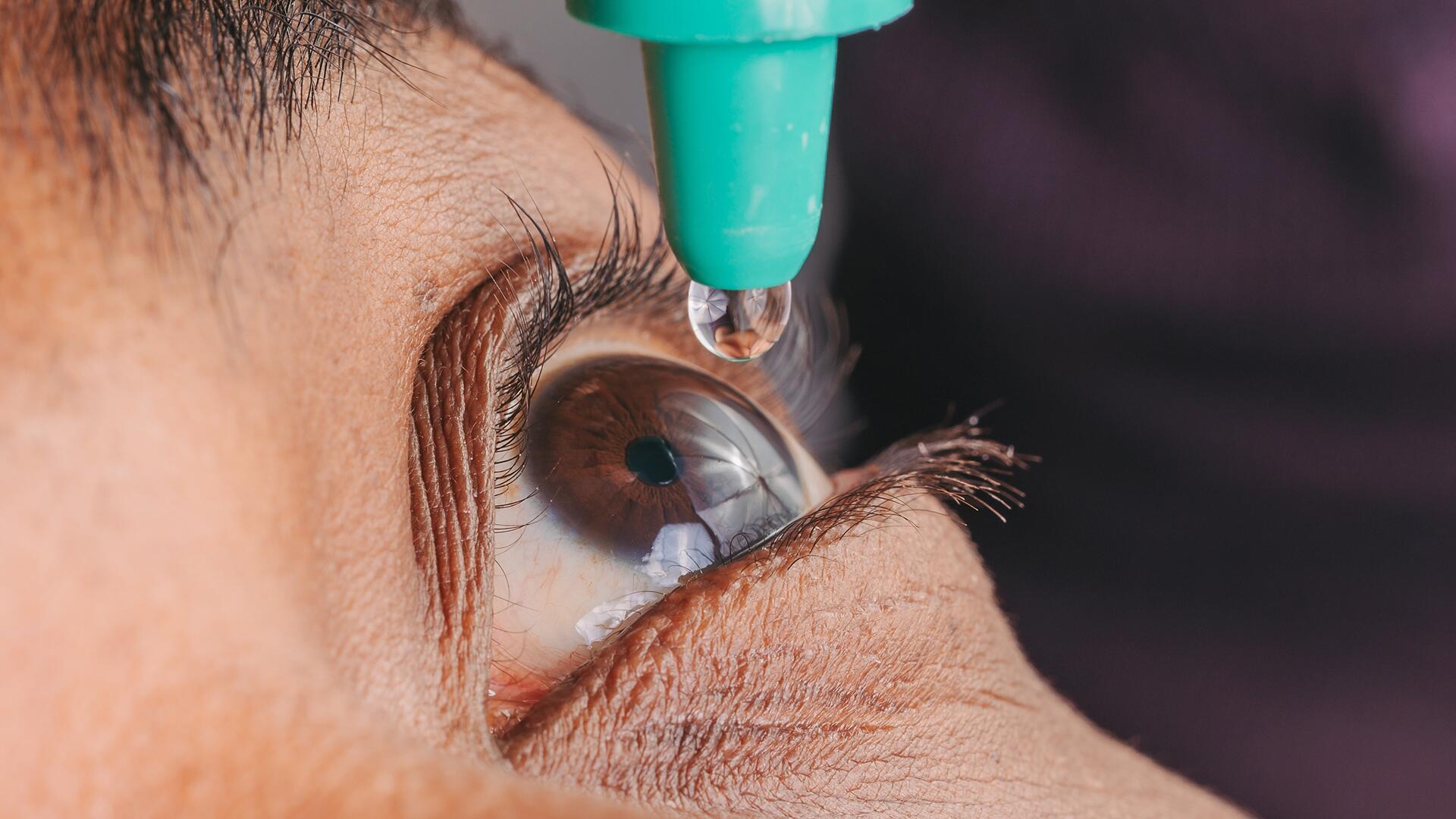 Mittel gegen trockene Augen im Test: Es geht auch ohne Konservierungsmittel Mittel gegen trockene Augen im Test: Es geht auch ohne Konservierungsmittel