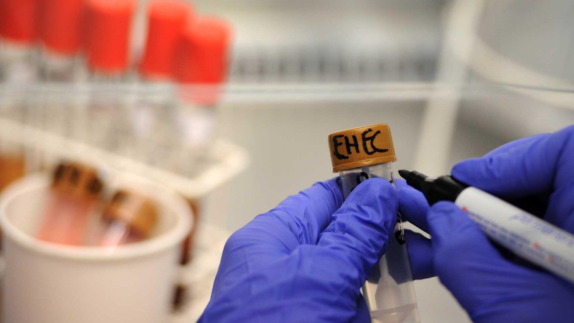 Ehec-Bakterien: So können Sie Infektionen im Alltag vorbeugen Ehec-Bakterien: So können Sie Infektionen im Alltag vorbeugen